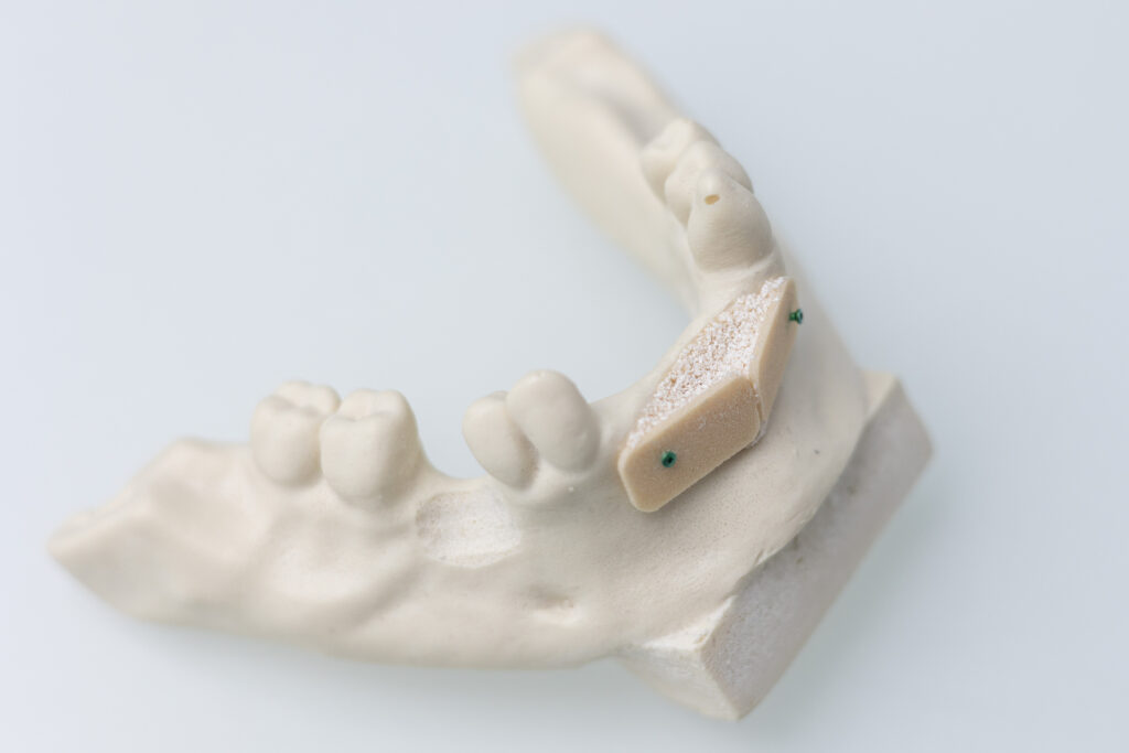 Knochenaufbau Modell